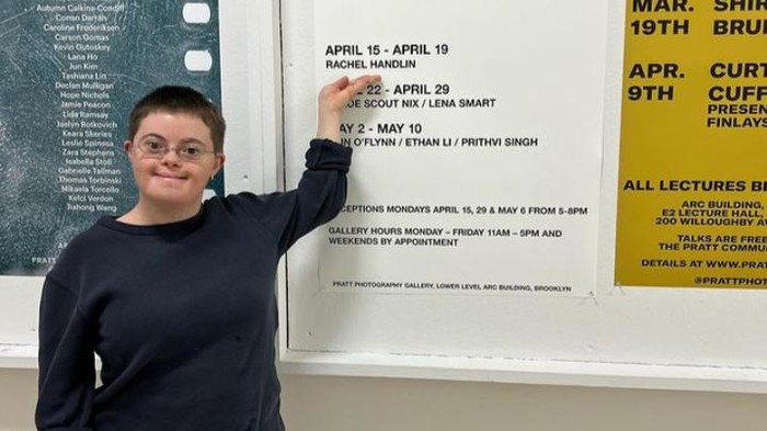 Kisah Rachel Handlin, Perempuan Down Syndrome yang Berhasil Lulus dari Universitas Bergengsi