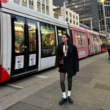 Karyawan Alice Norin Jadi Korban Kecelakaan Kereta, Begini Kondisinya