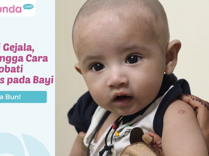 Waspada Bun! Kenali Gejala, Ciri hingga Cara Mengobati Herpes pada Bayi