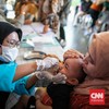 Kekhawatiran adanya efek samping imunisasi polio tetes menjadi kekhawatiran banyak orang tua. Namun komplikasi serius sangat jarang terjadi.