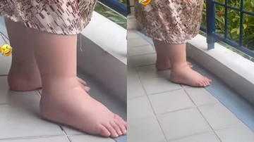 CIRI-CIRI KAKI BENGKAK SAAT HAMIL GEJALA PREEKLAMSIA