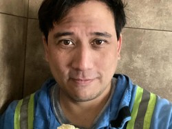 Tengku Firmansyah Alami Kecelakaan Kerja di Kanada, Jari Terjepit Besi!