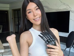 Wanita Ini Menjelma Jadi Robot Cantik Usai Tangannya Diamputasi