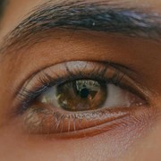 Ternyata Ketombe Bisa Muncul di Alis! Apa Penyebabnya?