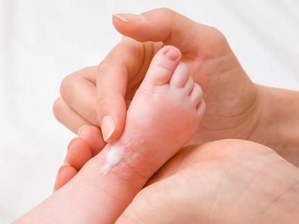 9 Penyebab Bentol Berair pada Kulit Bayi dan Cara Mengatasinya