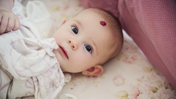 Mengenal Tanda Lahir Merah di Kepala Bayi