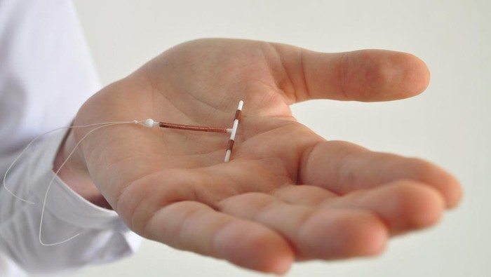 KB IUD