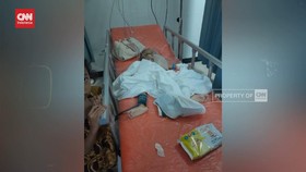 VIDEO:Orang Tua Asuh Diduga Aniaya 2 Balita. Korban Kakak-adik Kritis