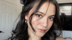 Kondisi Mata Marsha Aruan H+2 Kegebok Bola Padel