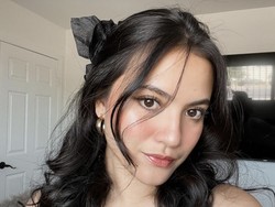 Kondisi Mata Marsha Aruan H+2 Kegebok Bola Padel