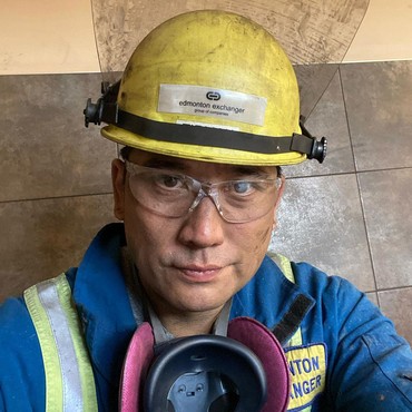 Begini Kondisi Tengku Firmansyah usai Jari Kejepit Besi Saat Kerja di Kanada