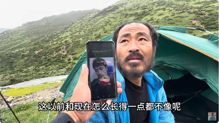 Usai Putus Cinta, Pria Berusia 24 Tahun Mendadak Menua Hanya dalam Waktu 5 Bulan! Ini Kisahnya...