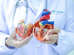 Mitral Valve Replacement: Penanganan Kasus Katup Jantung di Mayapada