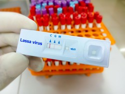 Kata Epidemiolog soal Demam Lassa yang Picu 163 Orang Meninggal di Nigeria