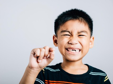 Kondisi Seperti Apa yang Membuat Anak Harus Cabut Gigi?