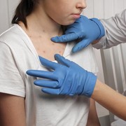 8 Gejala Virus Mpox atau Cacar Monyet Menurut WHO, yang Kini Mulai Mewabah di Indonesia!