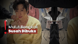 Dirahasiakan Setahun, Jang Geun Suk Ternyata Idap Kanker Tiroid