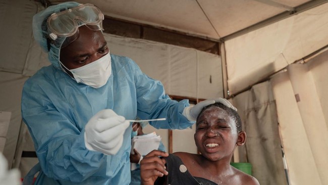 Pemerintah akan mendatangkan 1.600 dosis vaksin Mpox dari Denmark yang didistribusikan kepada tenaga medis garda terdepan serta kelompok berisiko tinggi.