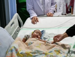Dokter RSU Soetomo Pisahkan Kembar Siam Dempet Bokong, Satu Bayi Meninggal