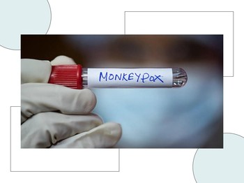 Waspada, Wabah Monkeypox Jadi Global Emergency!