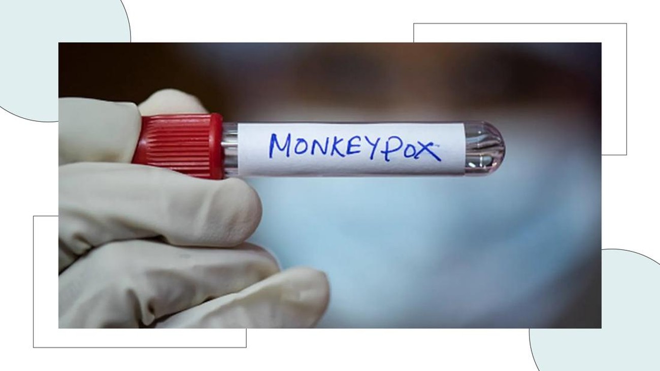 Waspada, Wabah Monkeypox Jadi Global Emergency!