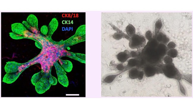 Sekelompok ilmuwan berhasil membuat organoid kelenjar susu dengan saluran 3 dimensi. Simak tujuan dan teknik penciptaannya.