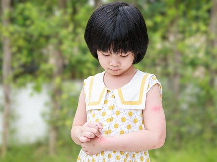 Campak pada Bayi, Kenali Penyebab, Ciri-ciri, dan Cara Mengobatinya