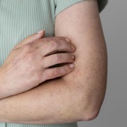 Kulit Kasar dan Berbintik, Begini 4 Cara Menghilangkan Chicken Skin