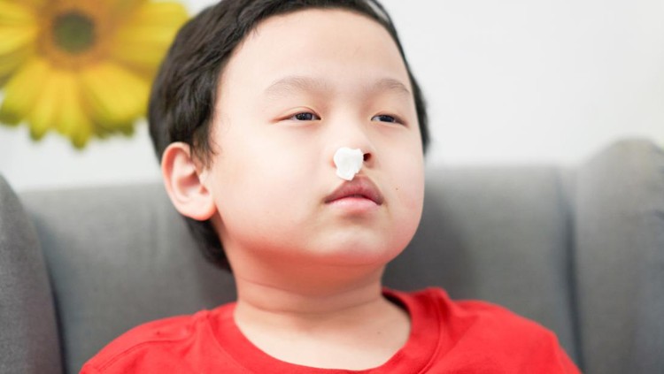 Penyebab anak mimisan