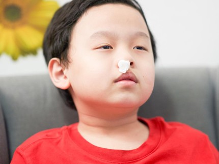 Anak Sering Mimisan, Waspadai Penyebab dan Ciri-ciri Berbahayanya