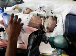 Video: Pengakuan Warga Gaza 5 Hari Belum Makan
