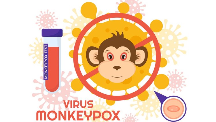 Monkeypox