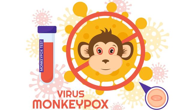 Waspada Monkeypox atau Cacar Monyet pada Anak dan Bayi, Ketahui Proses ...