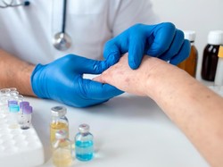 7 Gejala Virus Mpox atau Cacar Monyet yang Mulai Mewabah di Indonesia