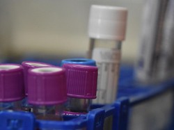 Kata Menkes Soal Pemakaian SATUSEHAT untuk Antisipasi Penyebaran Mpox