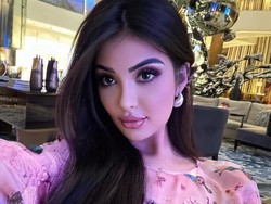 Influencer Oplas agar Mirip Kim Kardashian, Berakhir Merusak Masa Depannya