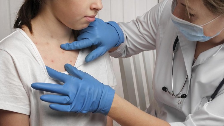 Doctor Checking Skin of Sick Girl. Kid with Red Rash being Examined at the Physician. Allergic Rash, Chicken pox, Monkeypox Symptoms on the Body of Child. Health Problem. Bacterial Infections, Disease. Small Child with Red Rash. Baby with Red Spots Blisters on the skin. Close up of Painful Rash. Health Problem. Rubella, Chickenpox, Scarlet fever, Measles. Bacterial Infections, Disease.
