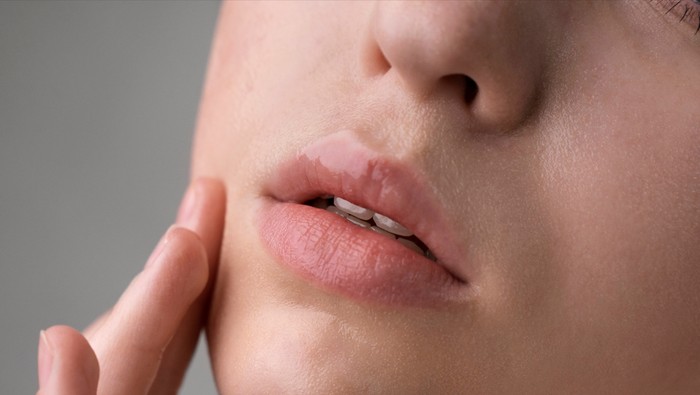 img-title Kulit Kering di Sekitar Bibir? Ini Dia 4 Cara untuk Mengatasinya