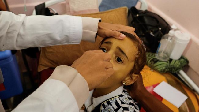 UNRWA Desak Gencatan Senjata Selama Vaksin Polio di Gaza