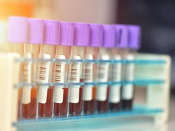 Kasus Mpox Varian Ganas Nambah Terus di Inggris, Total Jadi 3 Pasien
