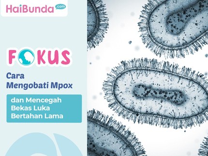 Cara Mengobati Mpox & Mencegah Bekas Luka Bertahan Lama