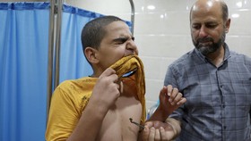 FOTO: Menyembuhkan Penyakit Lewat Terapi Sengat Lebah di Irak