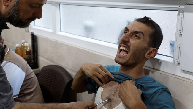 FOTO: Menyembuhkan Penyakit Lewat Terapi Sengat Lebah di Irak