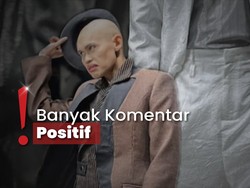 Wanda Hara Tampil di Fashion Show, Kepala Plontos Jadi Sorotan