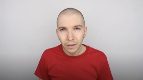 7 Bulan 'Hilang', YouTuber Nikocado Avocado Pamer Turun Bobot 113 Kg