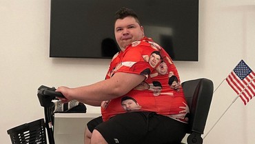 Penampilan Youtuber Mukbang Nikocado Avocado usai Turun BB 113 Kg Bikin Syok