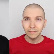 Fakta Ozempic, Obat Diabetes yang Viral Karena Kesuksesan Nikocado Avocado Turunkan BB 113 Kg