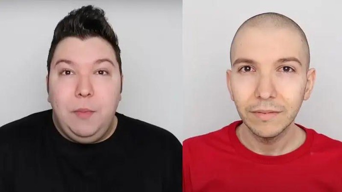 Fakta Ozempic, Obat Diabetes yang Viral Karena Kesuksesan Nikocado Avocado Turunkan BB 113 Kg