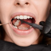 6 Bahaya Gigi Berlubang Kalau Dibiarkan Terlalu Lama, Awas Bisa Timbul Beragam Penyakit!