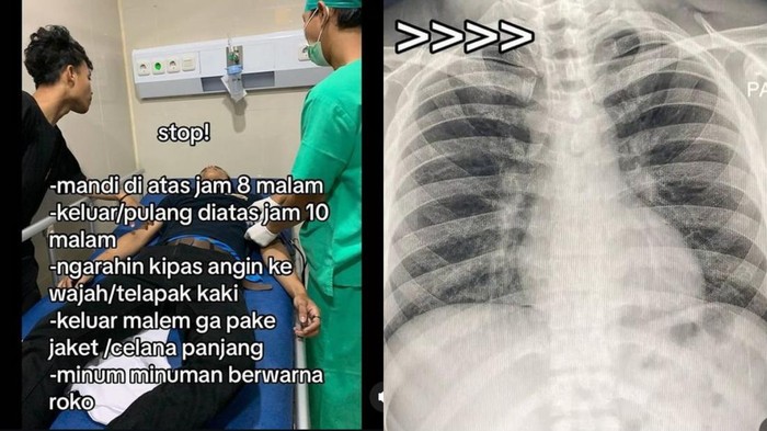 Menurut Dokter Ini yang Jadi Pemicu 'Paru-paru Basah', Bukan Mandi Malam-Pakai Kipas Angin!